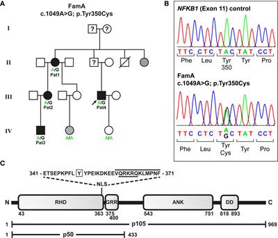 A Pathogenic Missense Variant in NFKB1 Causes Common Variable Immunodeficiency Due to Detrimental Protein Damage